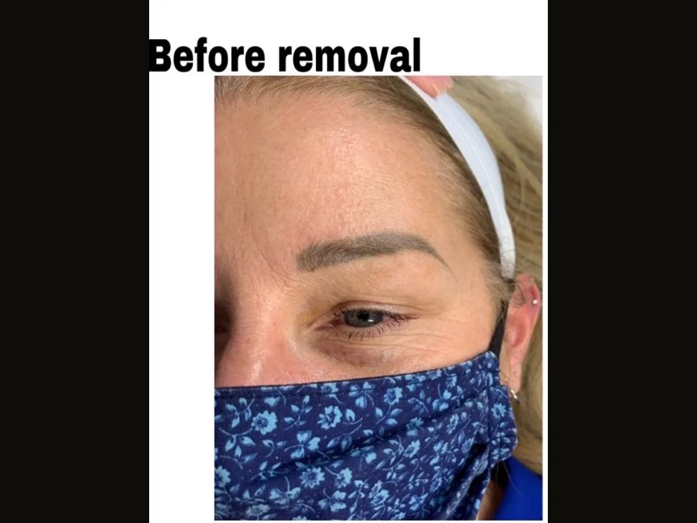 Real client with ashy / cool faded cool-toned brow tattoo before non-laser eyebrow tattoo removal at Aileen's Beauty in Campbell, California