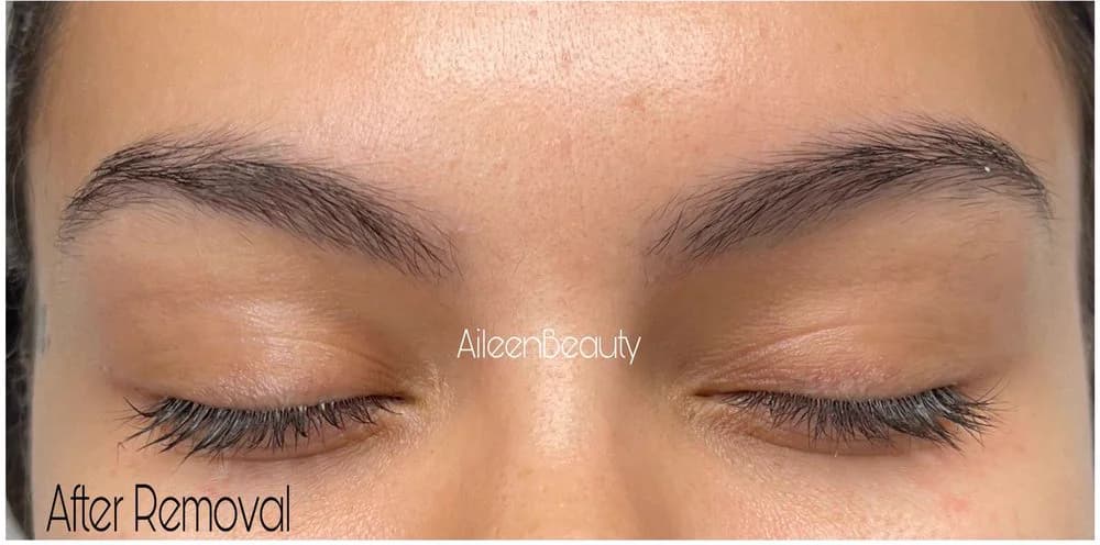 Dark ashy brow tattoo after non-laser eyebrow tattoo removal (real client, unretouched)