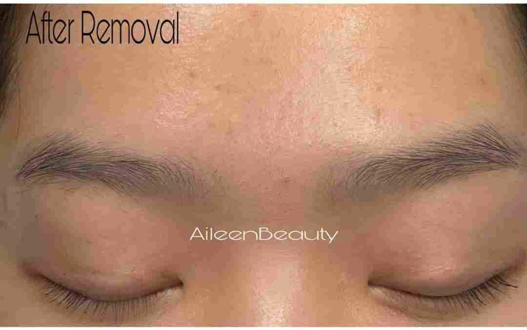 Old microblading after non-laser eyebrow tattoo removal (real client, unretouched)