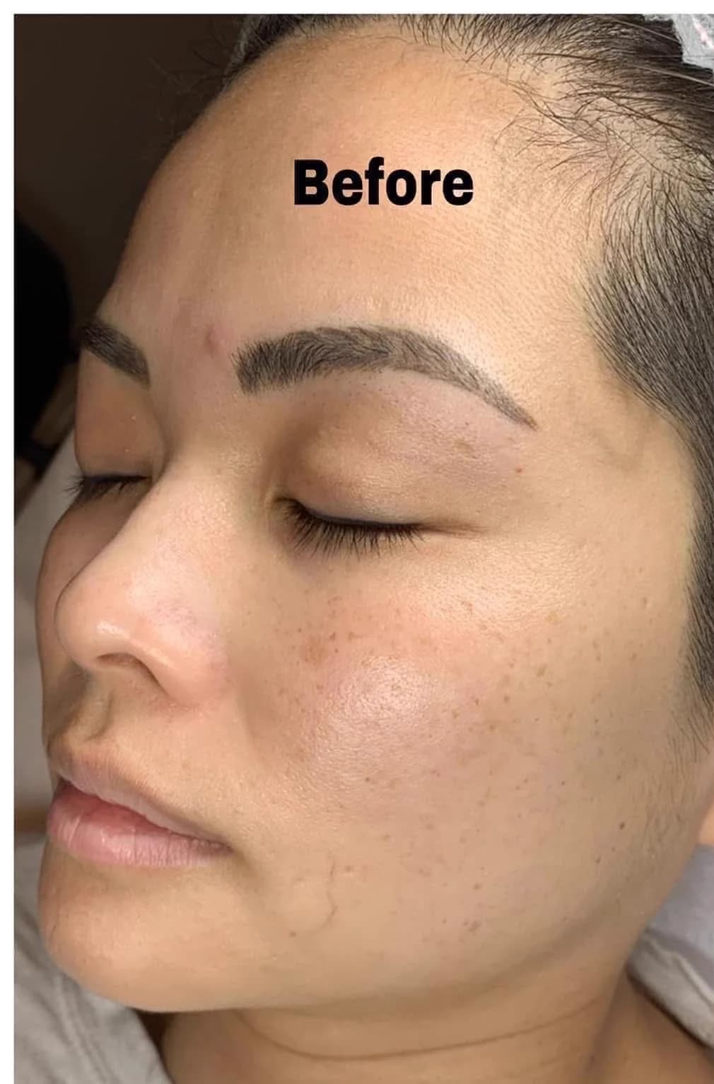 Real client before the Luxury La Mer facial series — uneven tone and texture