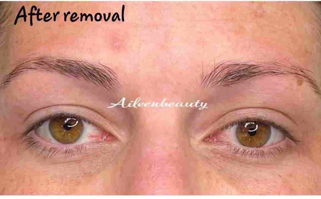 Saturated powder brows after non-laser eyebrow tattoo removal (real client, unretouched)