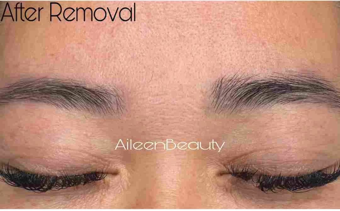 The same client after non-laser eyebrow tattoo removal at Aileen's Beauty — warm / uneven pigment visibly lifted